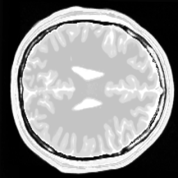 BrainOrig
