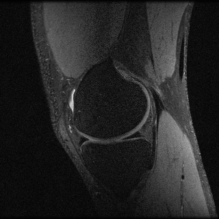 Knee Original